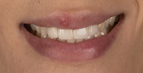 Smile Design Jessica Gomes Before