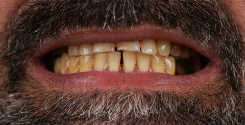 Smile Design Arian Before