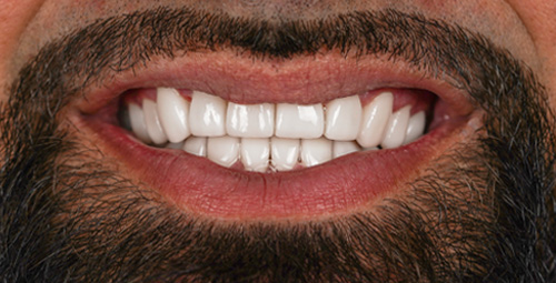 Smile Design Edwin After