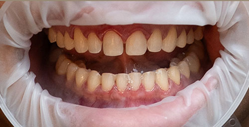 Smile Design Patient maribel Before