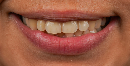 Smile Design Magda Before