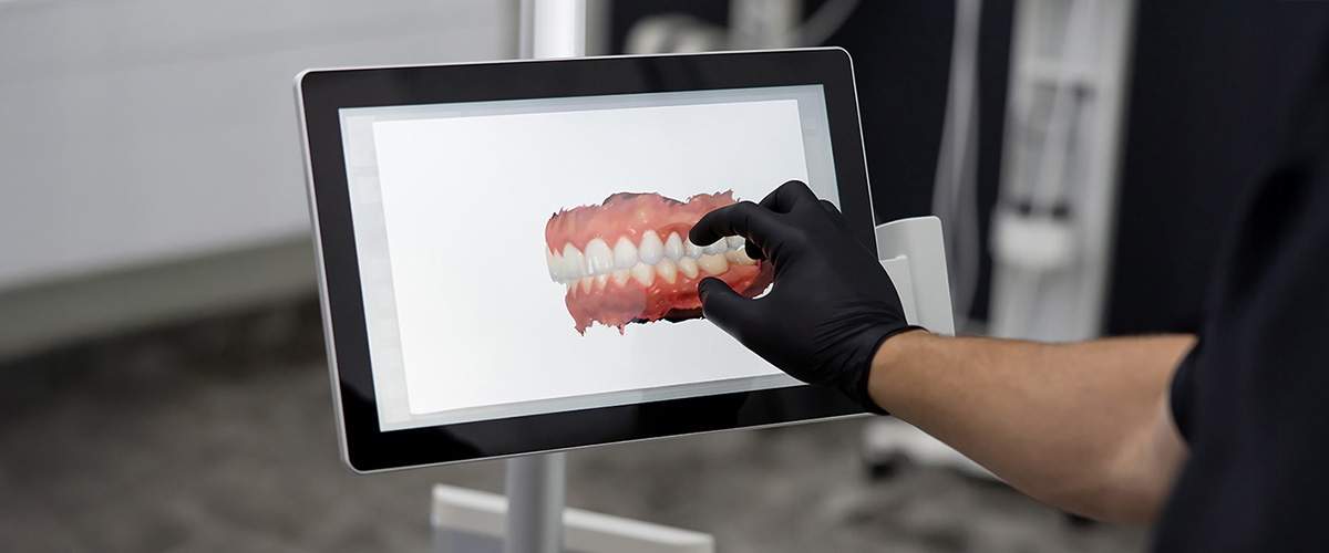 Common Smile Design Mistakes That Can Ruin Your Results