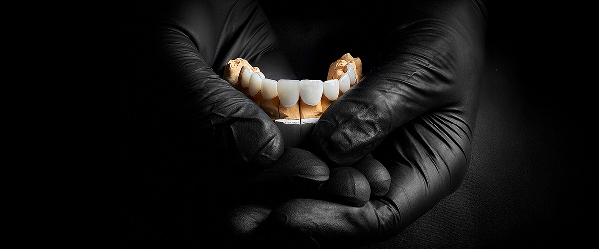Composite Veneers vs. Injected Resin Veneers: Dentist-Approved Comparison