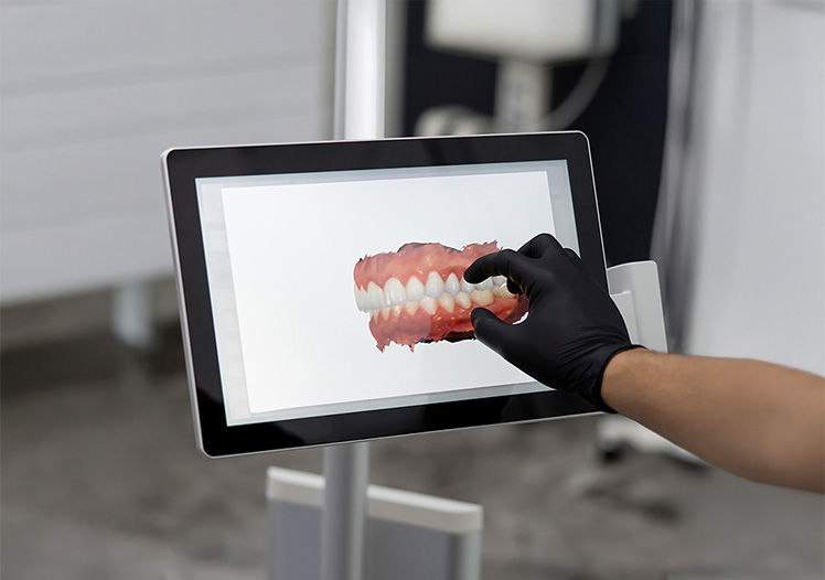 Common Smile Design Mistakes That Can Ruin Your Results