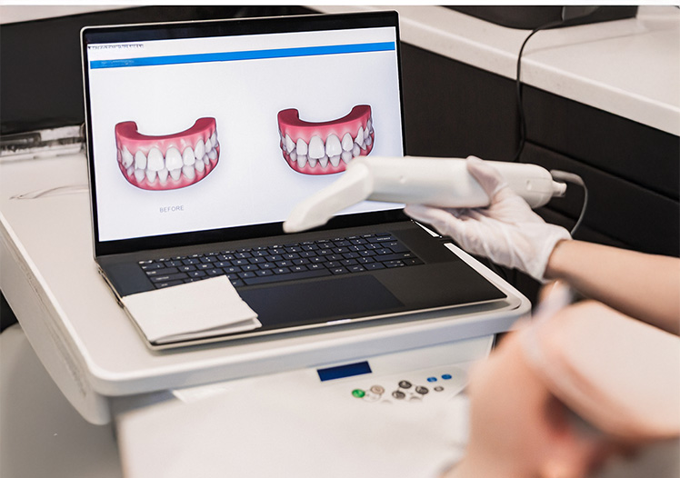 ¿Qué es el Diseño Digital de Sonrisa? Qué Esperar y Cómo Funciona
