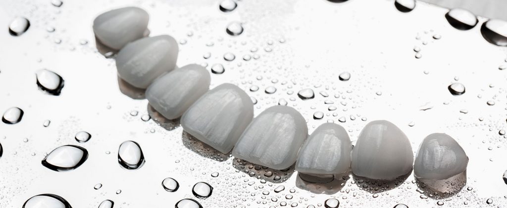 porcelain veneers vs resin veneers