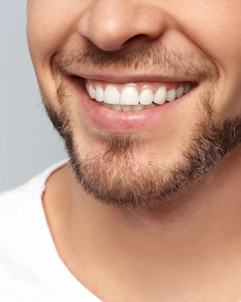 Teeth Cleaning in Miami