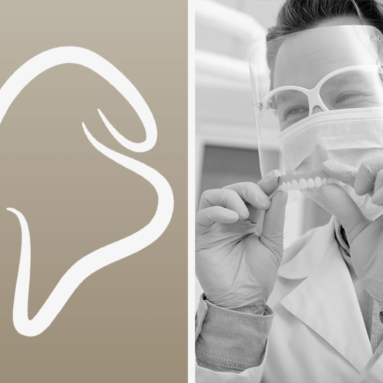 Sistema all-on-4 de protesis sobre 4 implantes dentales en Aria Smile Design