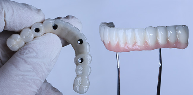 all-on-4 replace teeth system