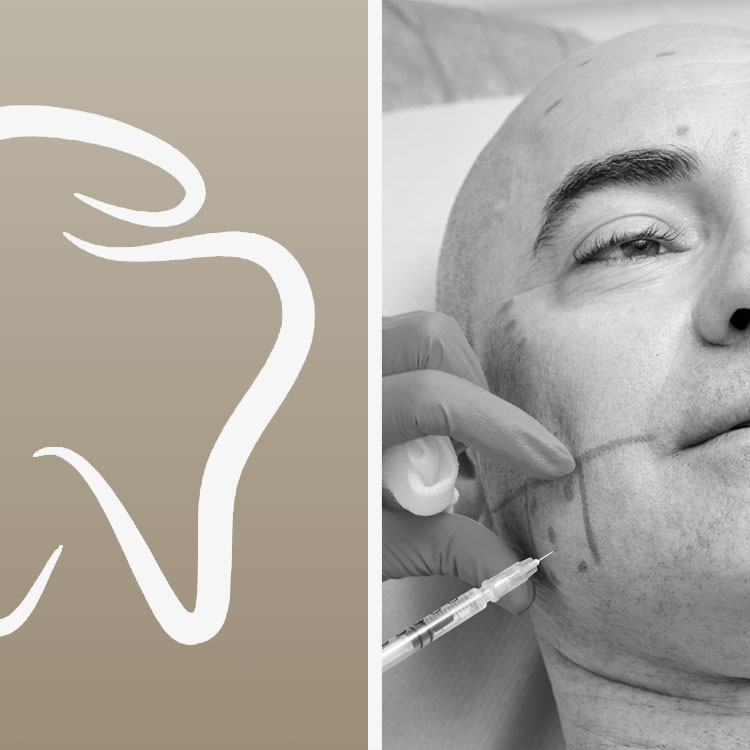 botox treatment for teeth grinding at Aria smile Design