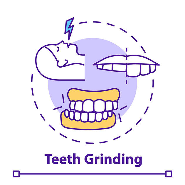 bruxism during Sleep causes and efects image representation