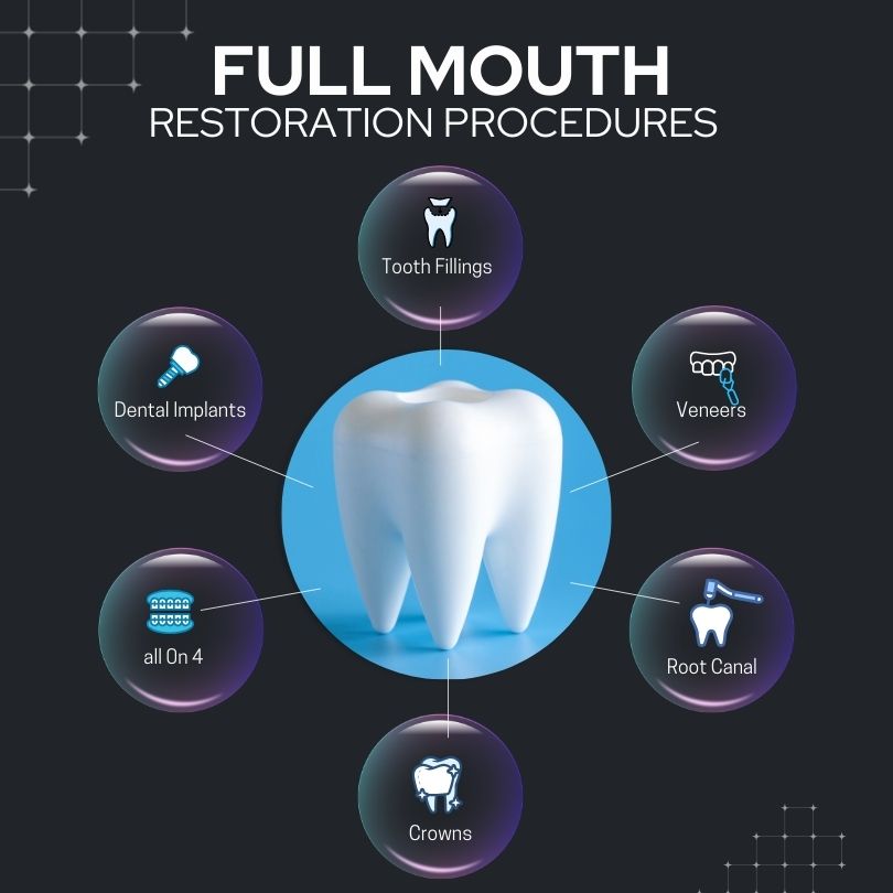 List of Procedures included in complete mouth restoration avaliable in Aria Smile Design