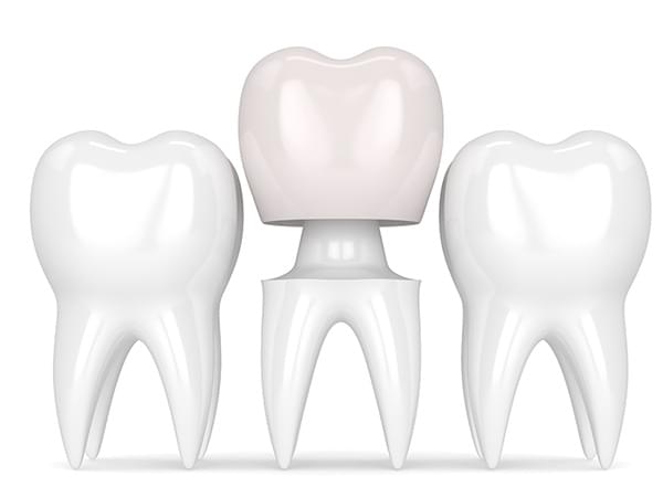 porcelain ceramic crown