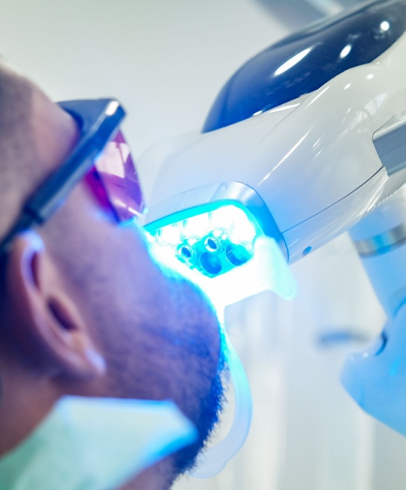 Blanqueamiento dental en el consultorio