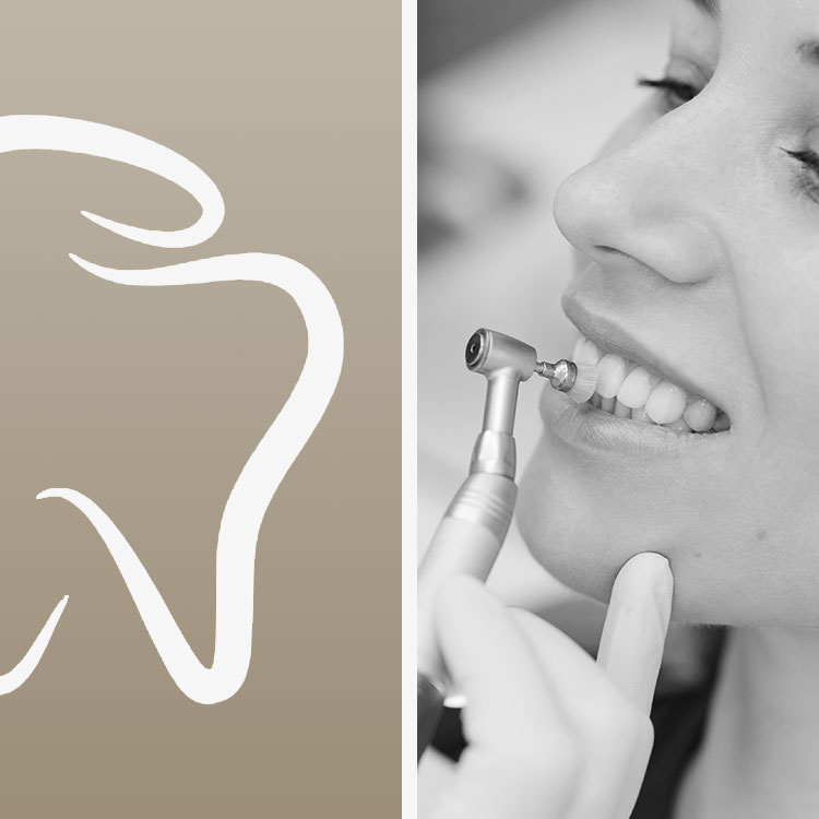 proffesional teeth cleaning in miami