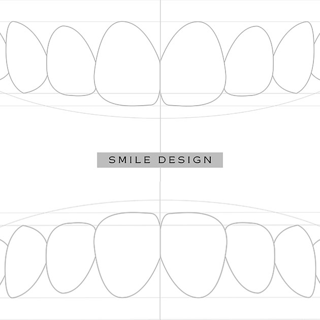 Diseno de sonrisa representacion grafica de arcos superiores e inferiores
