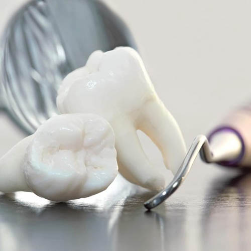 Proceso para Extracciones simples y quirugicas