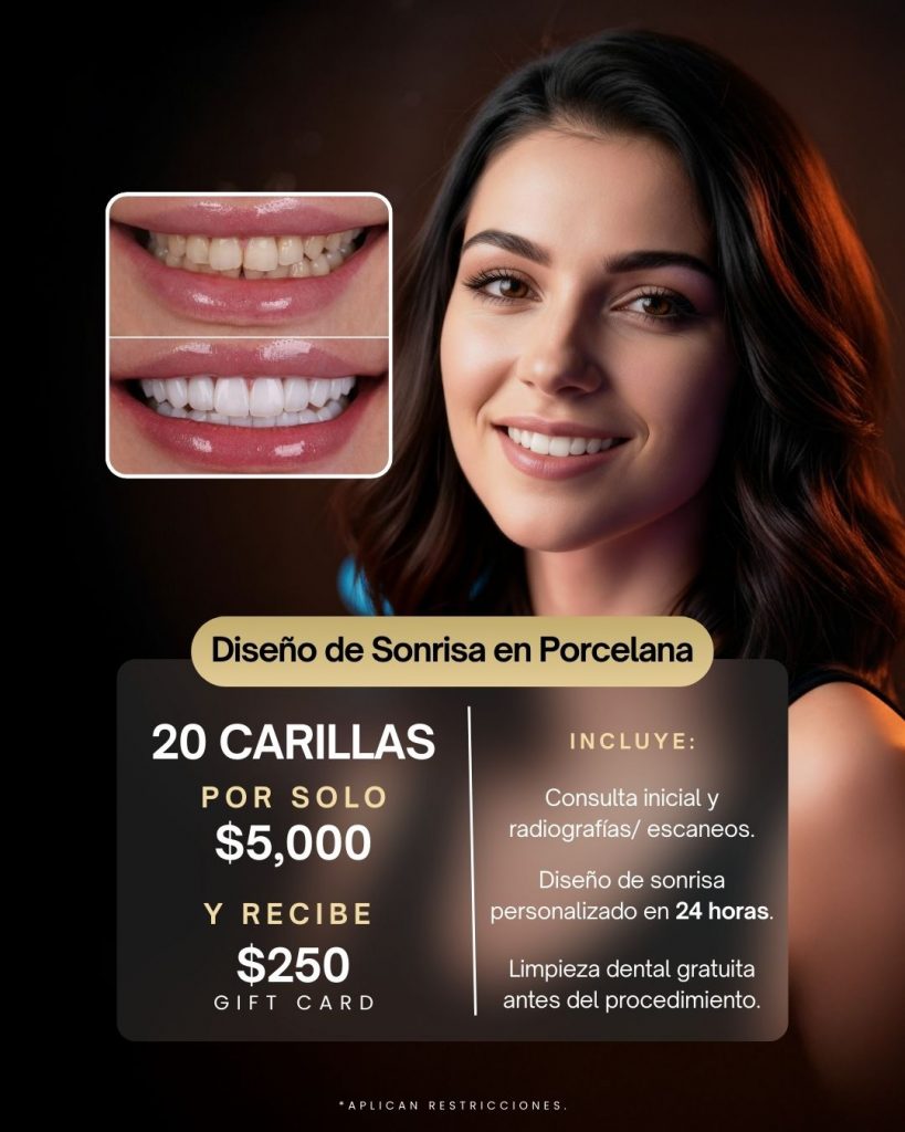 20 Carillas de Porcelana por solo $5000
