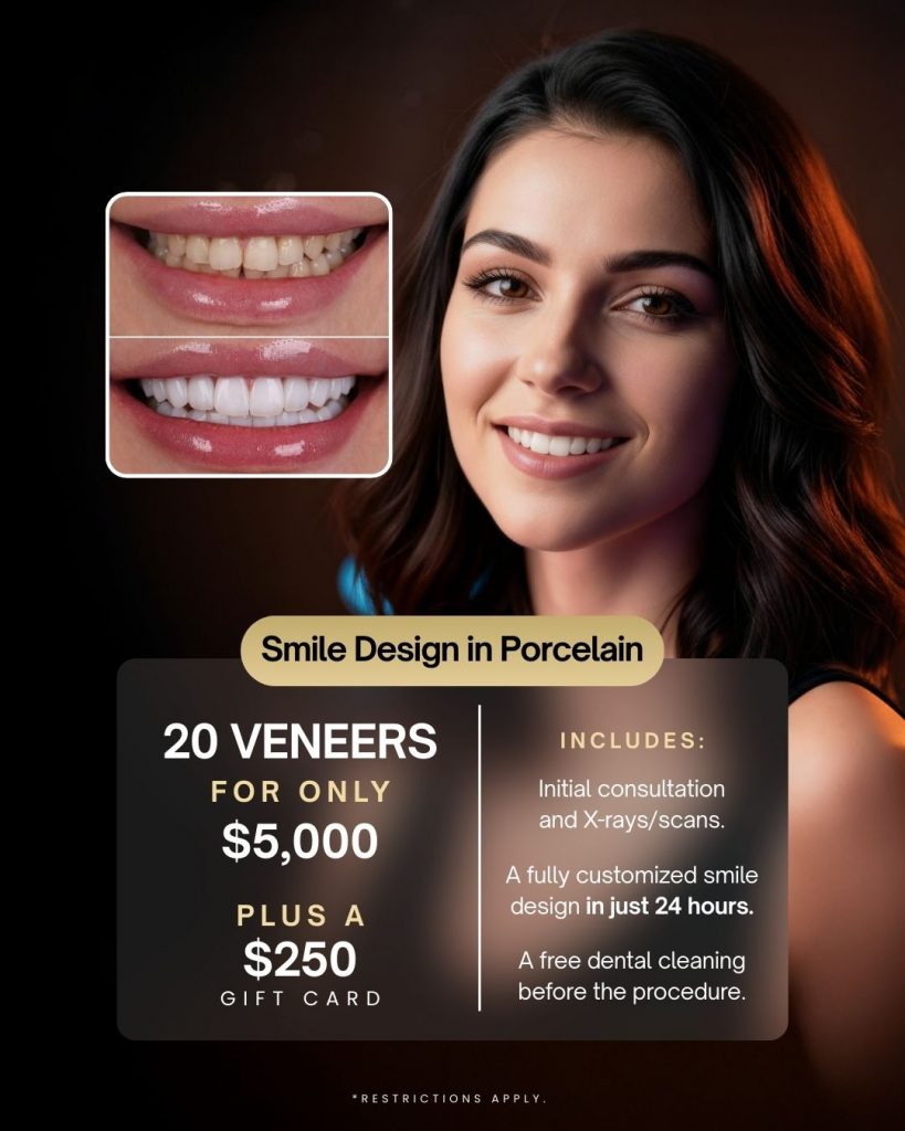20 Porcelain Veneers Special For Only $5000