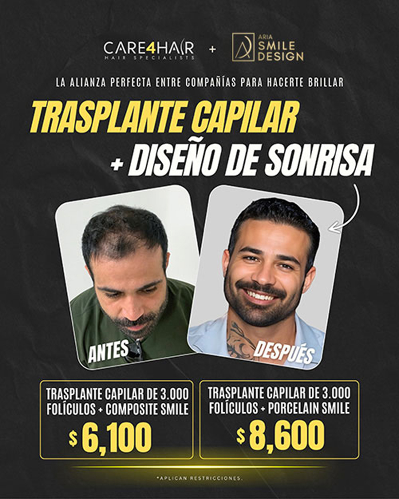 Combo de trasplante capilar y diseño de sonrisa