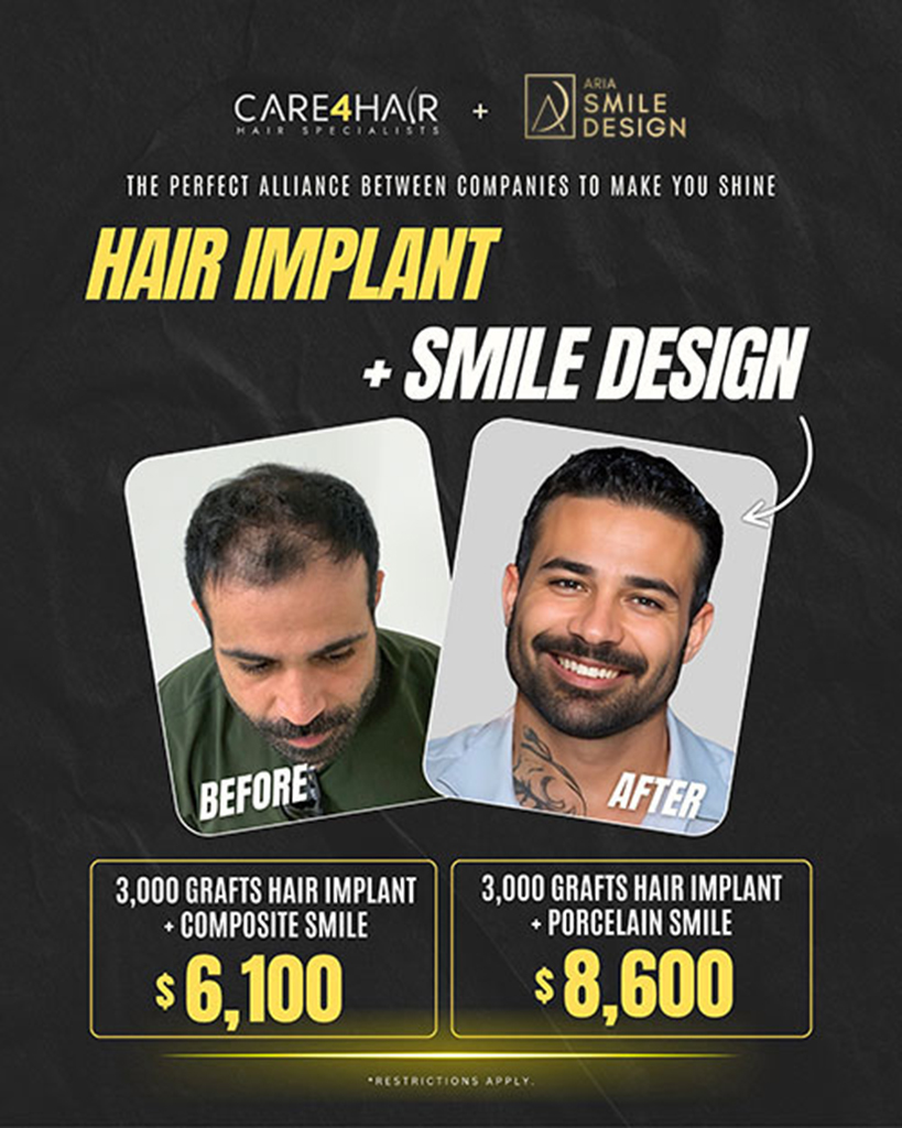 Combo hair transplant plus smile design