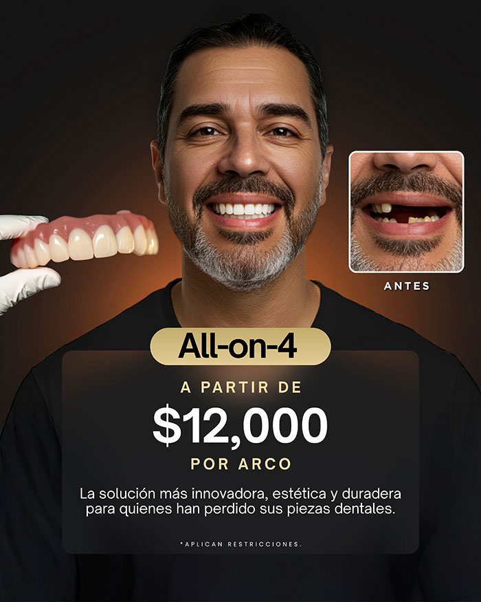Especial Protesis sobre implantes $12,000 por arco