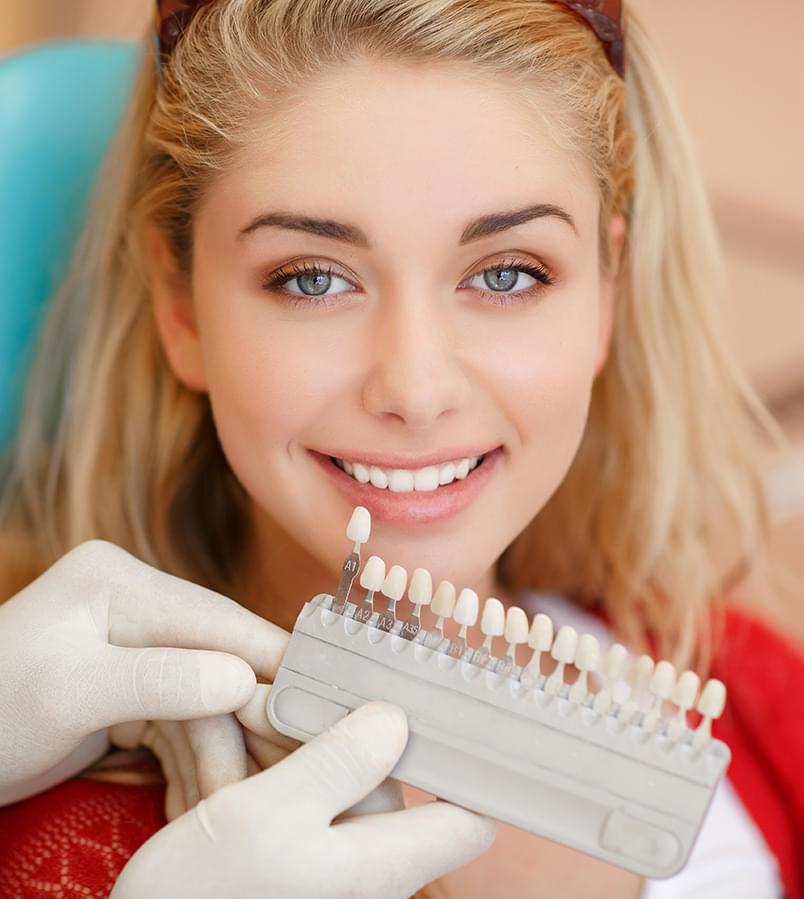 porcelain veneers female patient