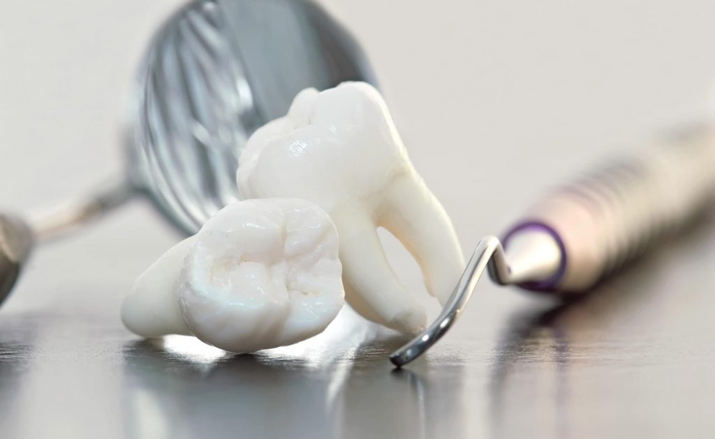 tooth extraction tools