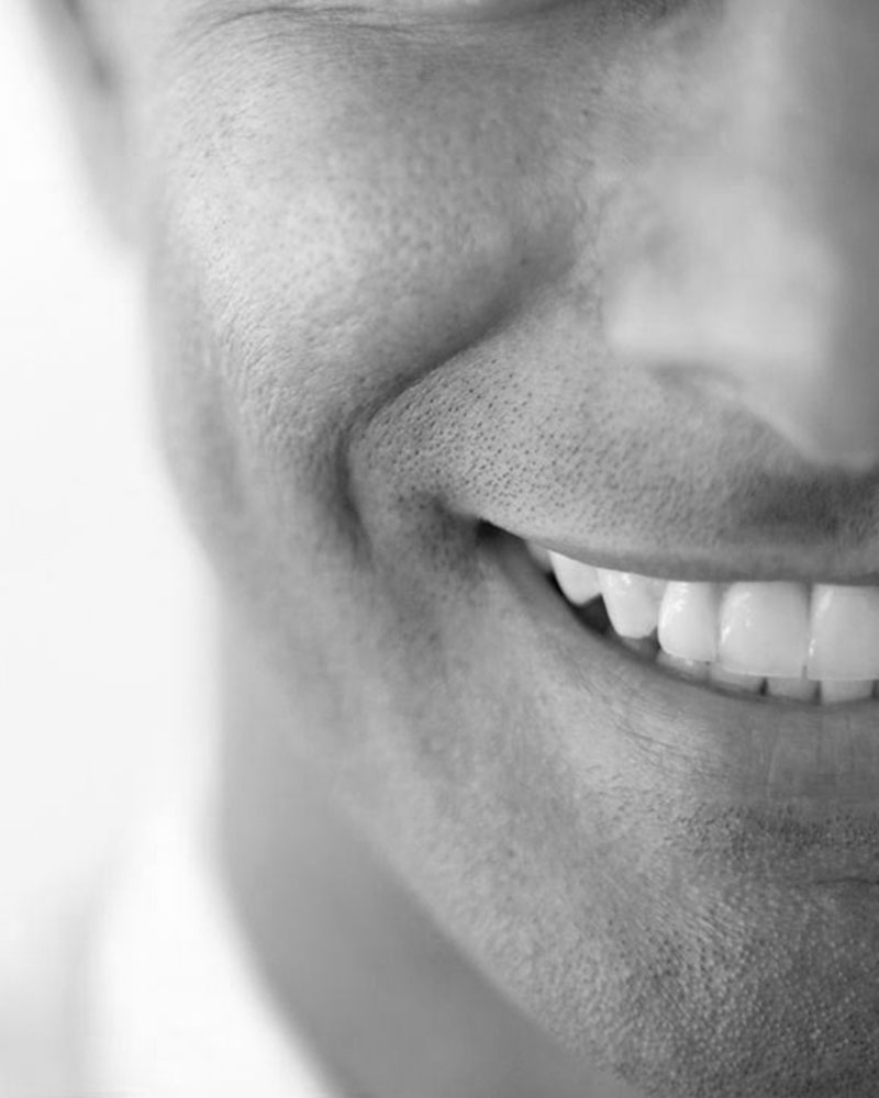 male smile design perfect teeth