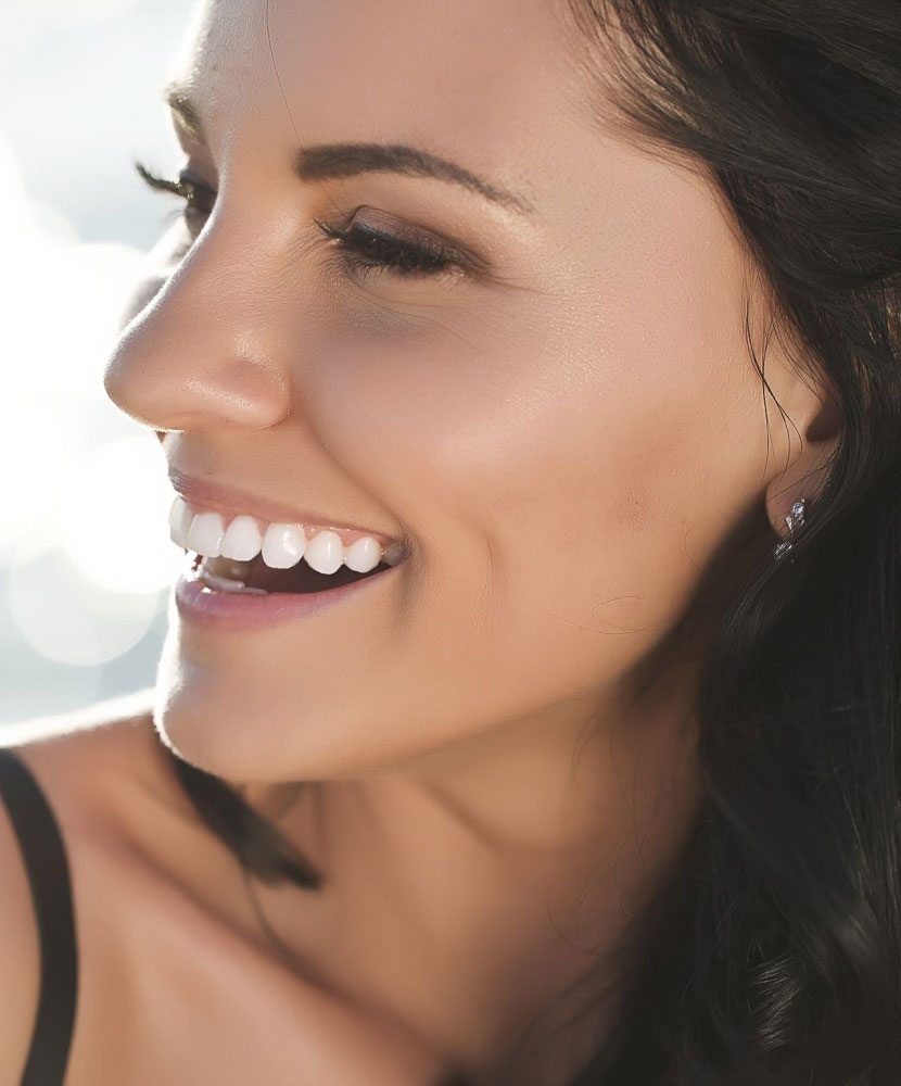 porcelain veneers