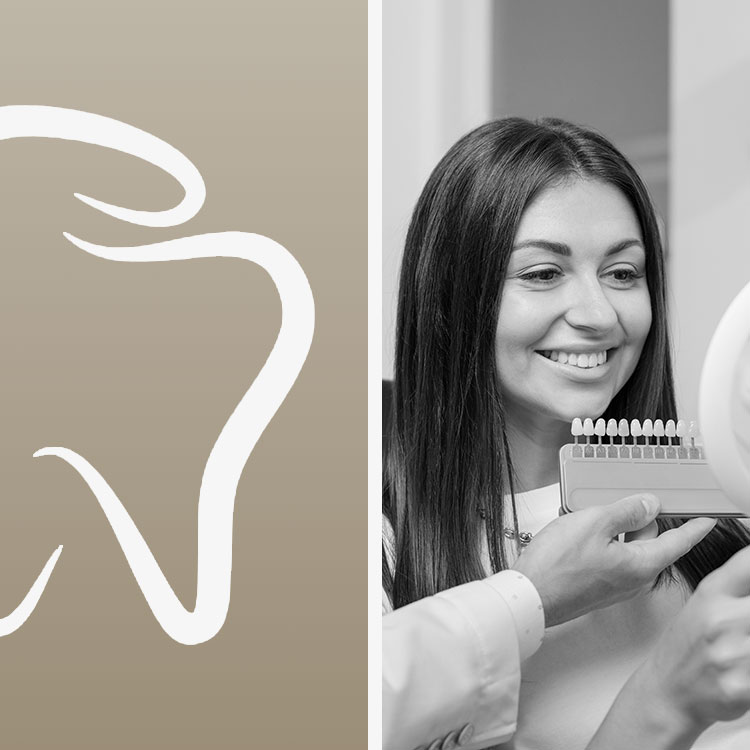 porcelain veneers miami service