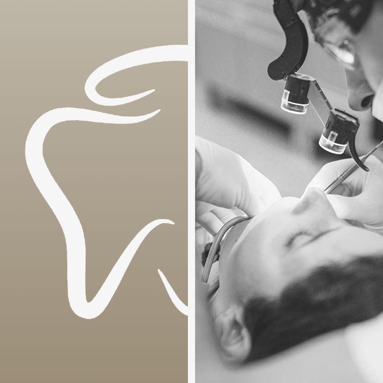 root canal treatment miami service