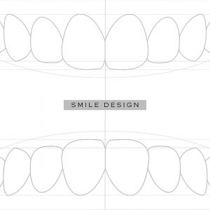 smile desig transformations text