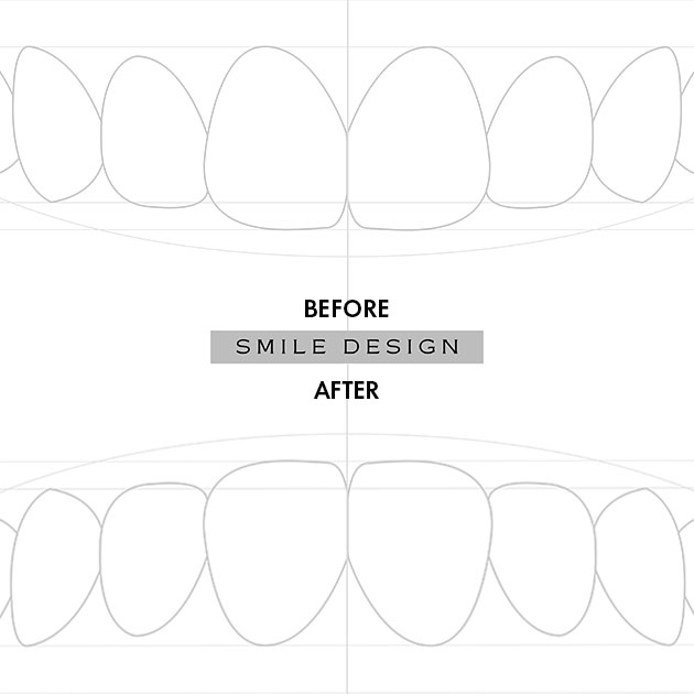 smile design transformations