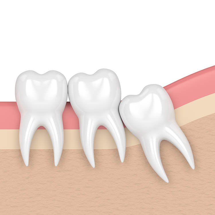 3d Render Of Teeth