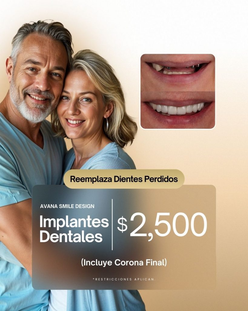 implantes dentales 2500 con corona incluida