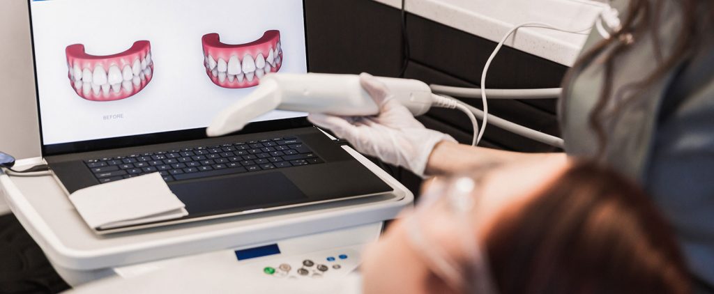 what is digital smile design DSD