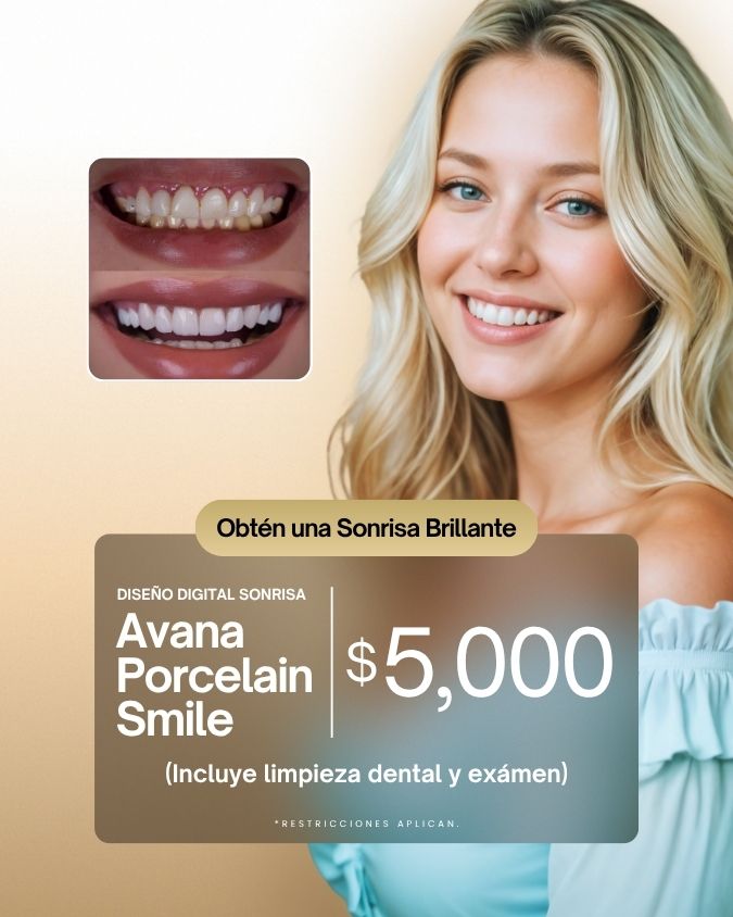 carillas dentales de porcelana $5000 precio especial