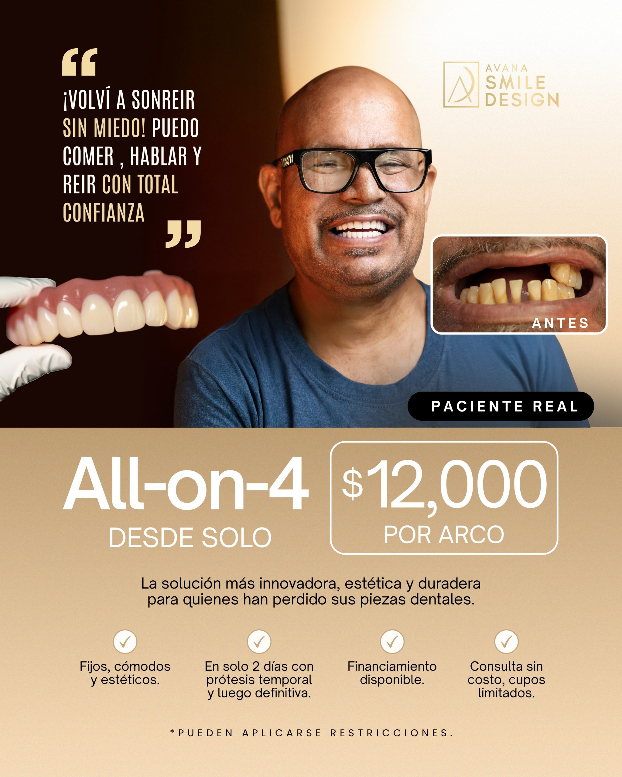implantes all on 4 ads