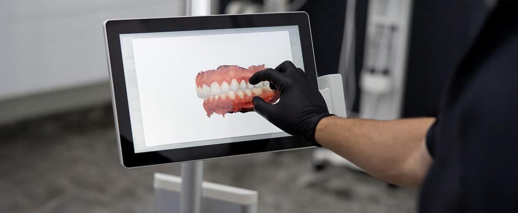 Common Smile Design Mistakes