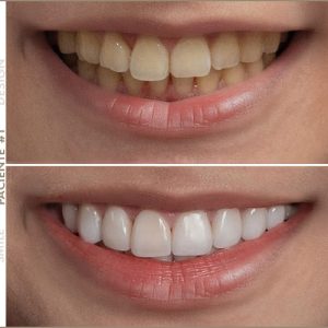 Paciente #1 Paciente #1