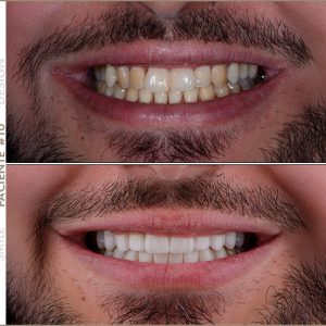 Paciente #10 Paciente #10