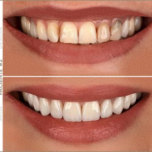 Paciente #2 Paciente #2