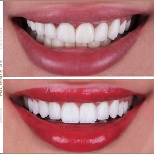 Paciente #5 Paciente #5