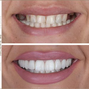 Paciente #6 Paciente #6