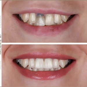 Paciente #7 Paciente #7