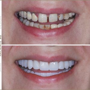 Paciente #8 Paciente #8