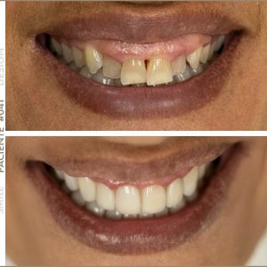 paciente smile design marlena hafferty