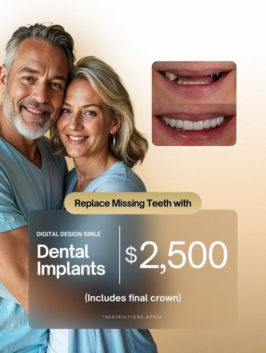 dental implant special $2500