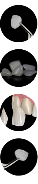 luminneers dental veneers luminneers dental veneers